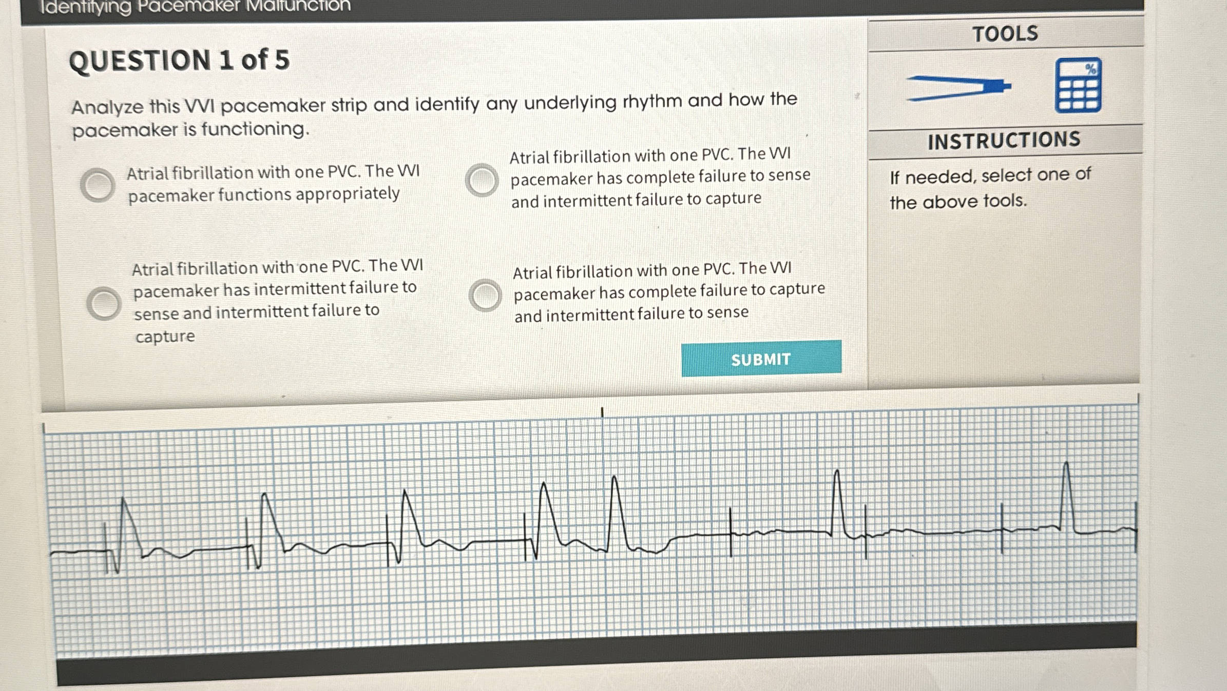 Solved Identifyng Pacemaker vialiunctionQUESTION 1 ﻿of | Chegg.com