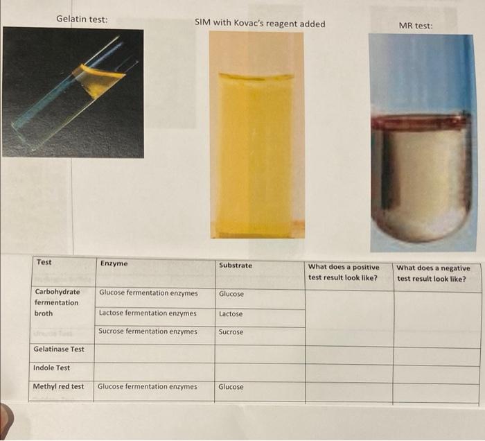 Solved Gelatin test: SIM with Kovac's reagent added MR test: | Chegg.com
