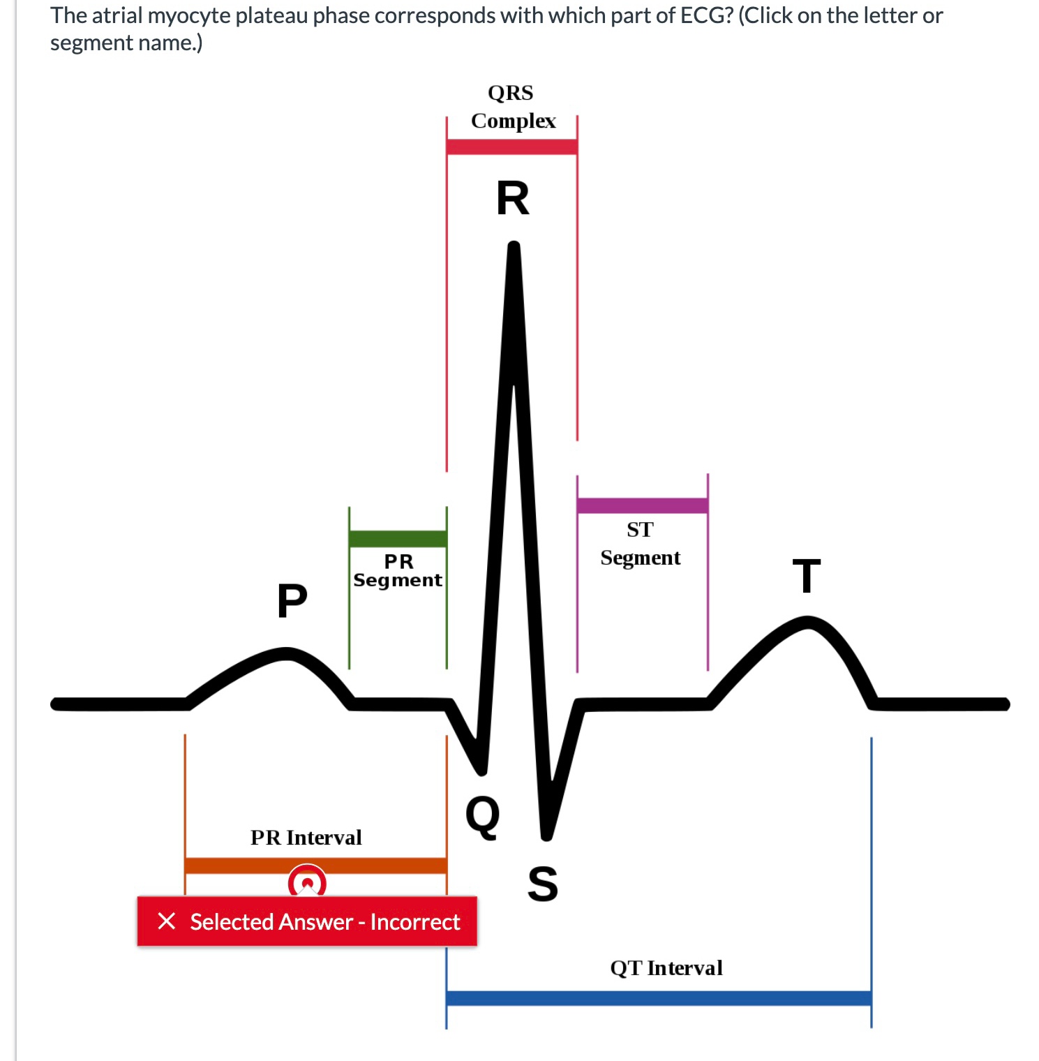 Solved The atrial myocyte plateau phase corresponds with | Chegg.com