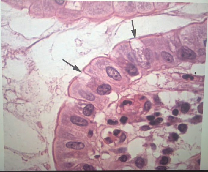 Identify The Shape Of The Cell Indicated By The Line Solved What type of cell is indicated by the arrow? | Chegg.com
