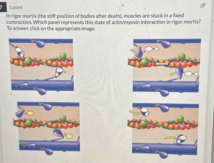 rigor mortis is contraction of muscles after death