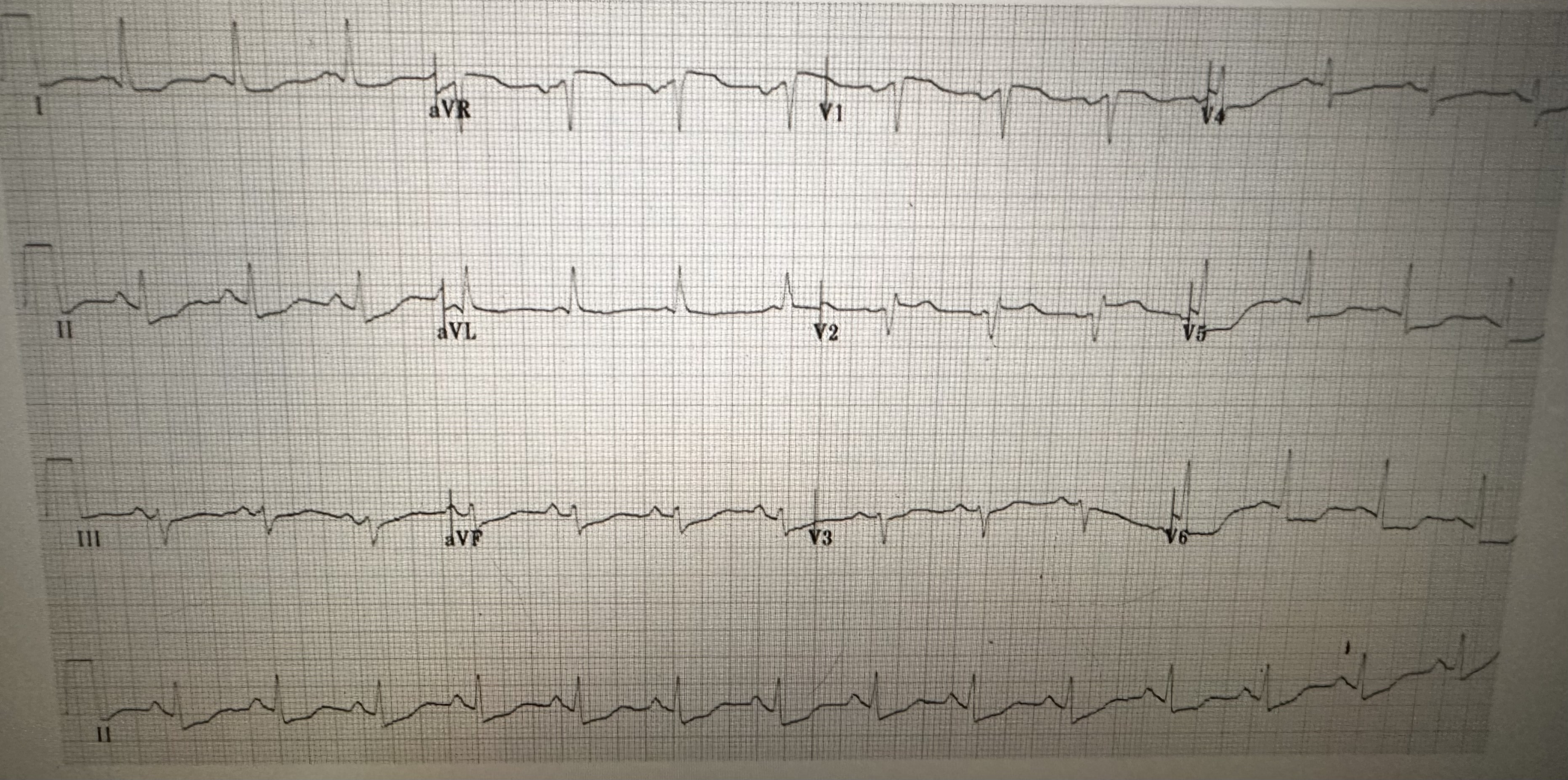 Solved 2. ﻿A 52 ﻿year old female presents to the emergency | Chegg.com
