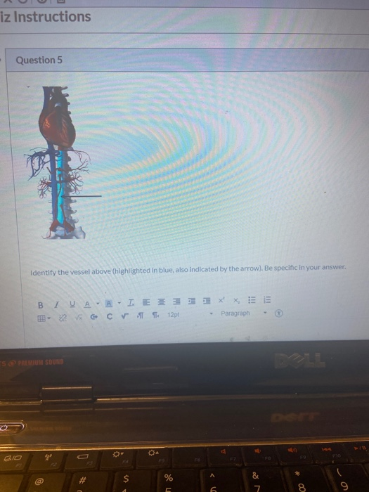 Solved iz Instructions Question 5 Identify the vessel above | Chegg.com