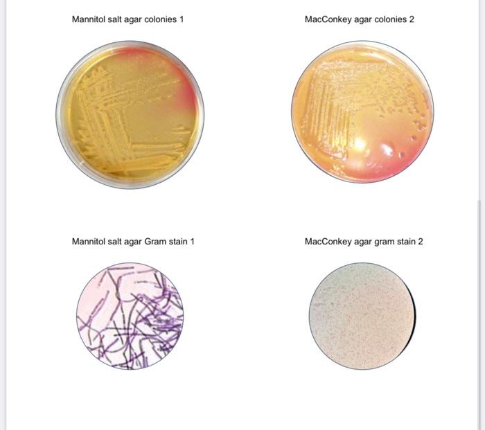 Solved Mannitol salt agar colonies 1 MacConkey agar colonies | Chegg.com