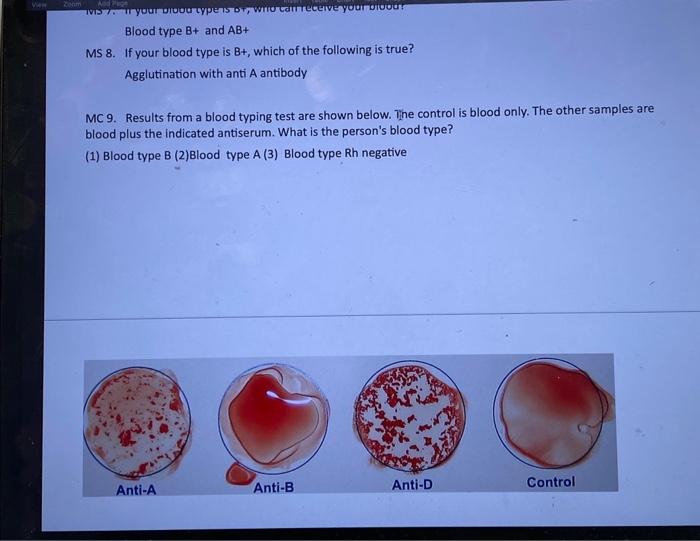 Solved Blood Type B+ And AB+ MS 8. If Your Blood Type Is B+, | Chegg.com