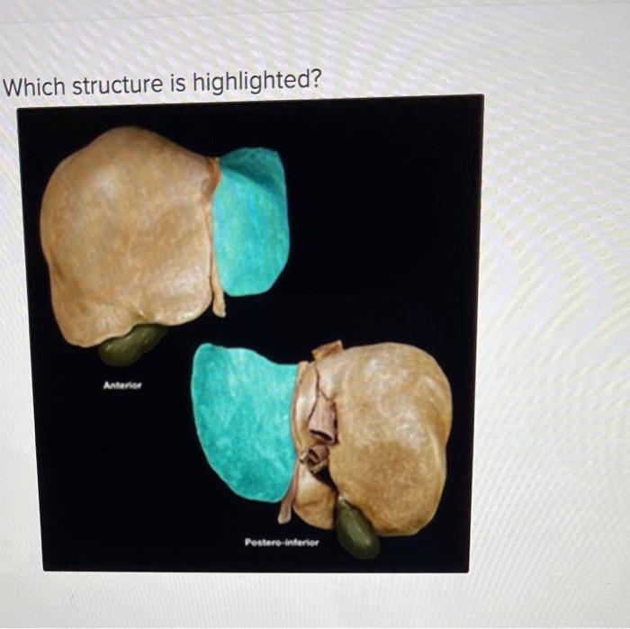 Solved Whirh ctrurture is hiahliahted? caudate lobe of