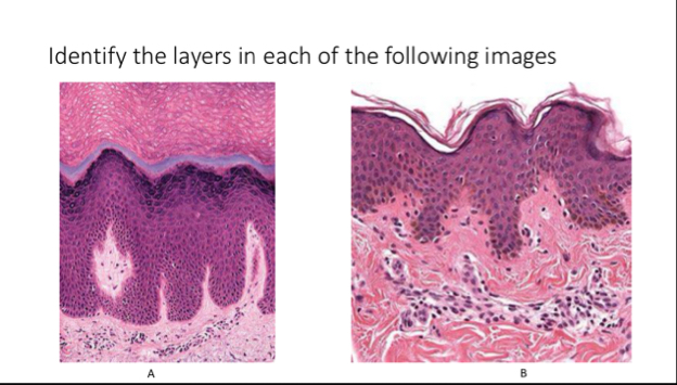 Solved Identify the layers in each of the following images. | Chegg.com