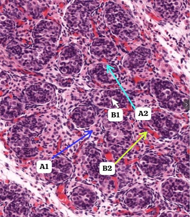 Identify the given histology slide.Label the arrows. | Chegg.com