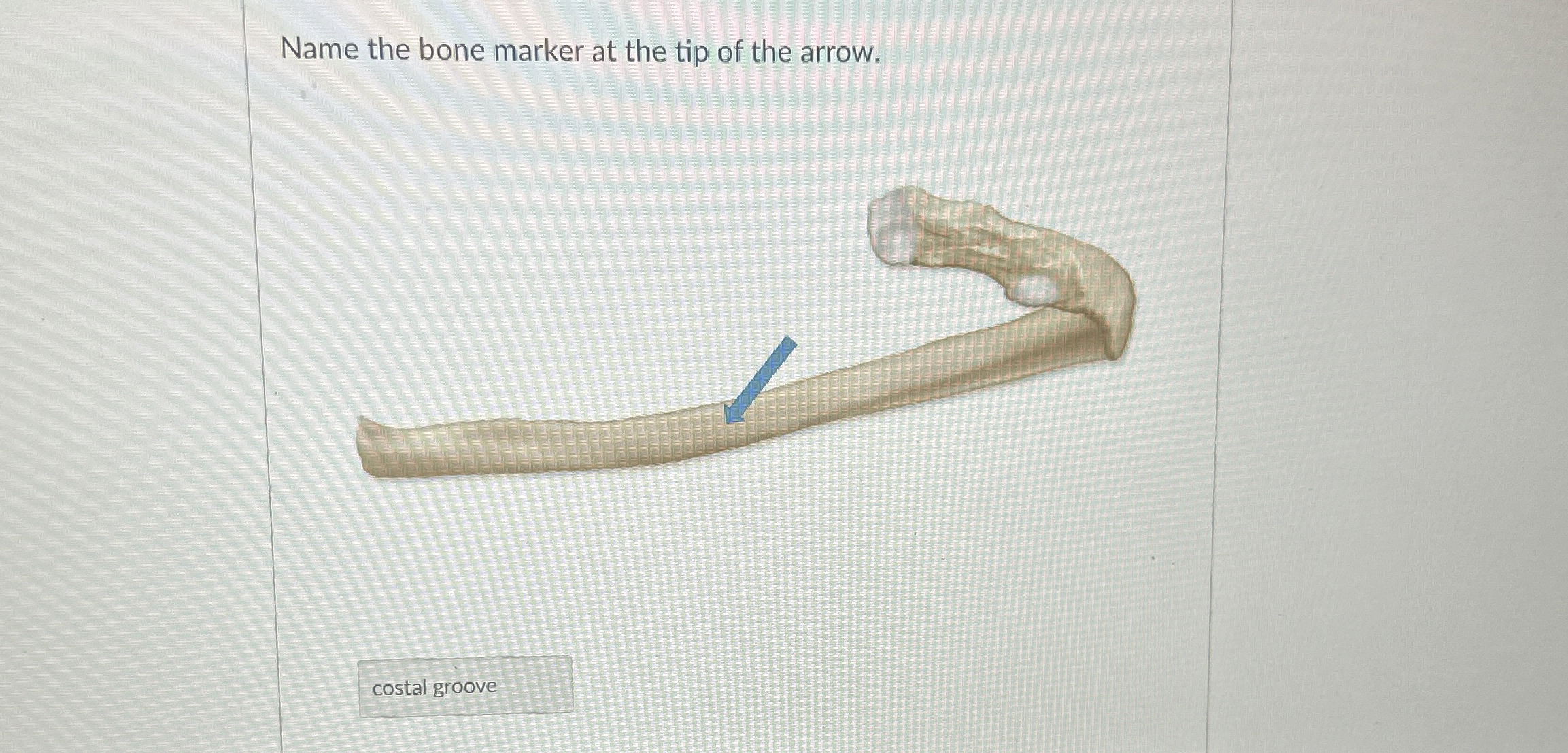 Solved Name the bone marker at the tip of the arrow. | Chegg.com