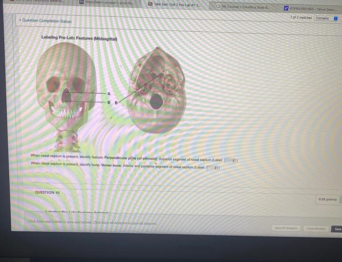 Solved QUESTION 7 Labeling Pre-Lab: Features of Cranial | Chegg.com