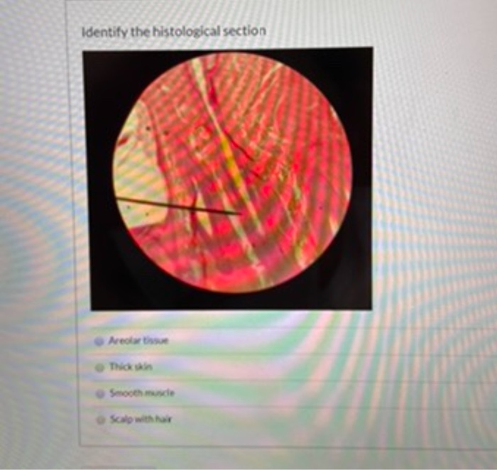 Solved Identify The Histological Section | Chegg.com