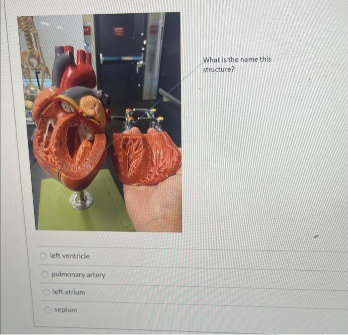 Solved What is the function of this organelle? storage of | Chegg.com