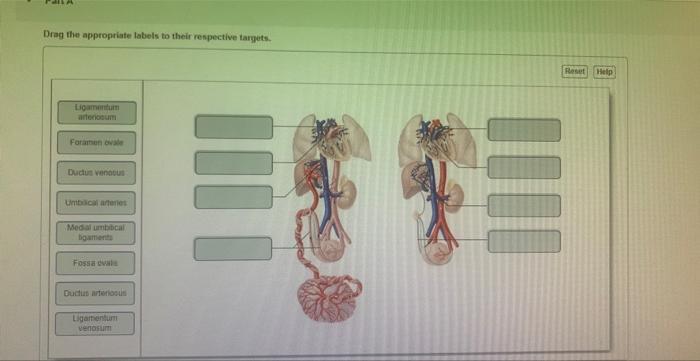 Drag the appropriate labels to their respective targets.
Ligamentum
arteriosum
Foramen ovale
Ductus venous
Umbilical arteries