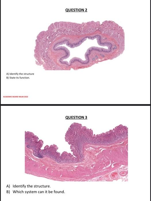 Solved QUESTION 2 A) Identify The Structure B) State Its | Chegg.com