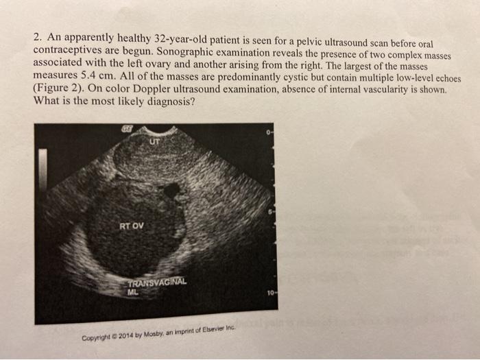 2. An apparently healthy 32-year-old patient is seen for a pelvic ultrasound scan before oral contraceptives are begun. Sonog