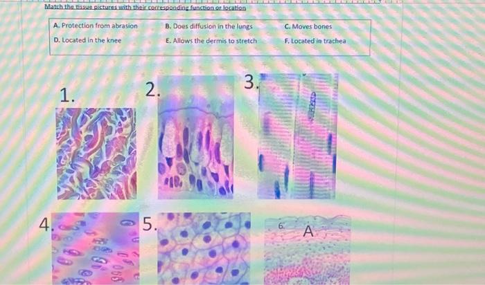 Solved Match The Tissue Pictures With Their Corresponding | Chegg.com