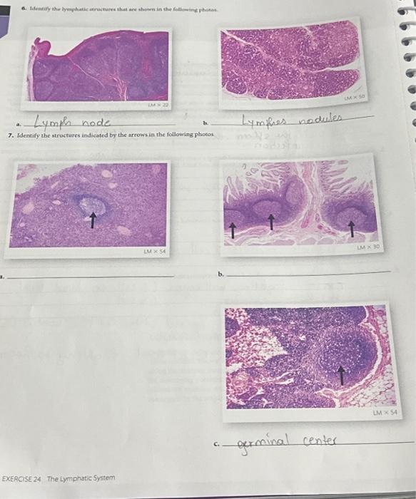 Don'T Ignore That Bump! How To Identify Wo Sind Lymphknoten Am Hals - q9lt5x2