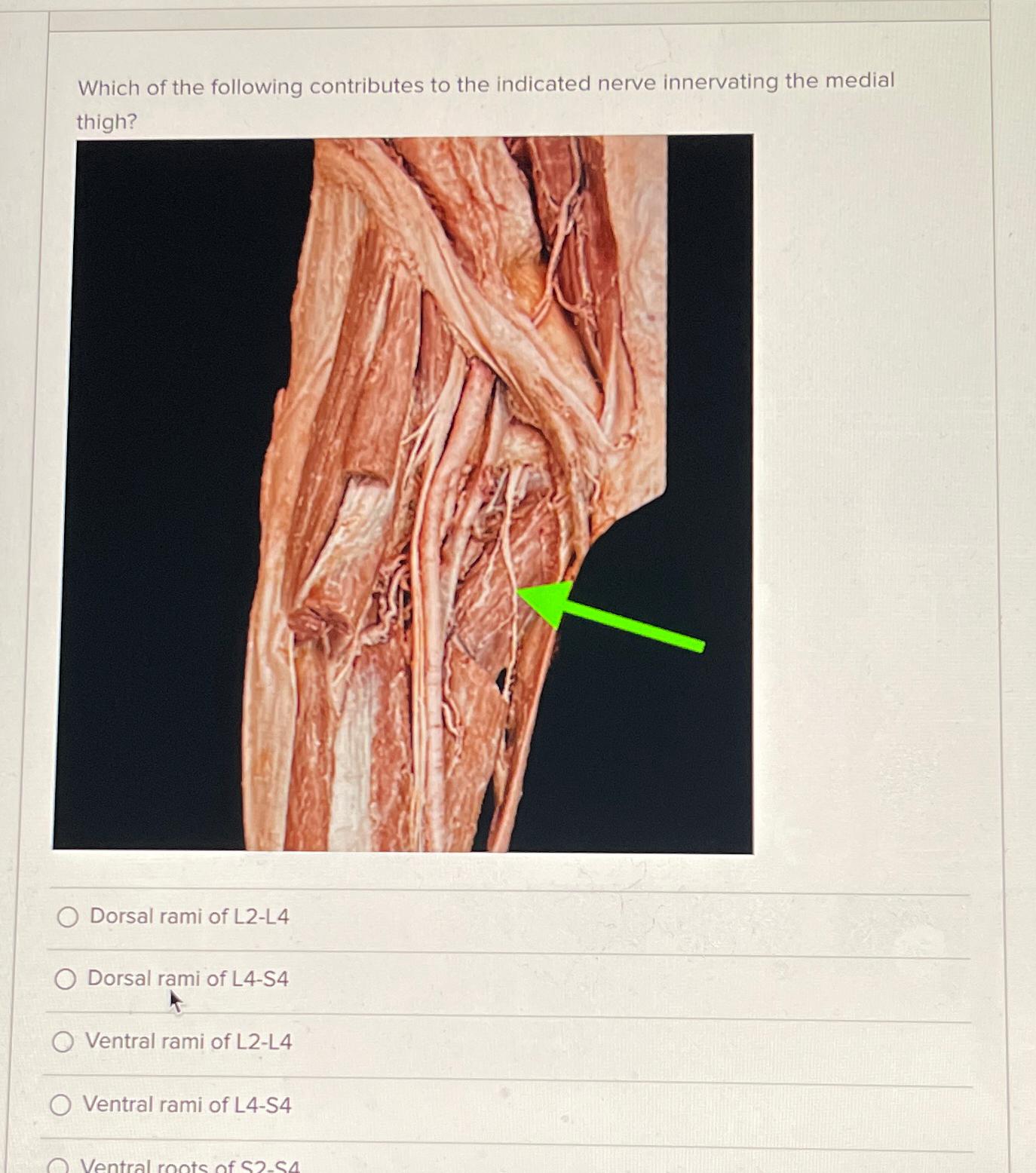 Solved Which of the following contributes to the indicated | Chegg.com