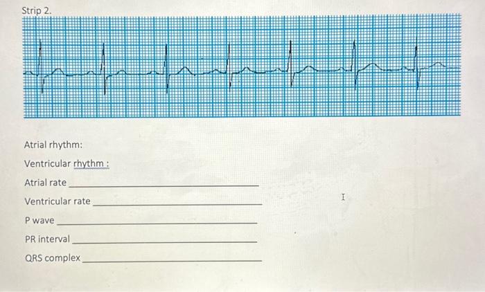 Solved Below is what an ECG grid looks like: The horizontal | Chegg.com