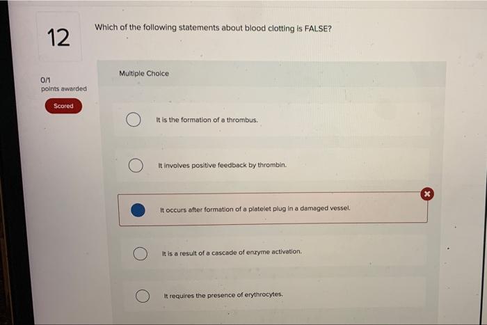 Solved Which of the following statements about blood | Chegg.com