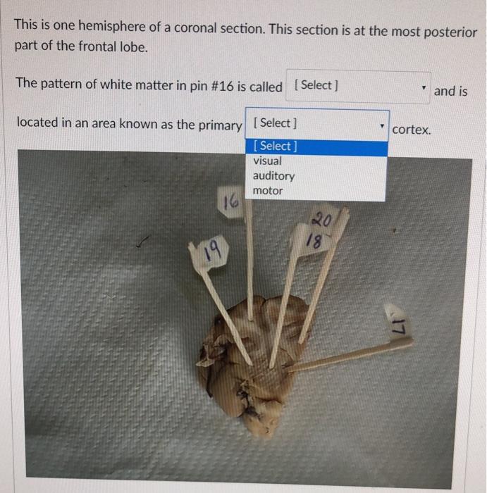 Solved This is one hemisphere of a coronal section. This | Chegg.com