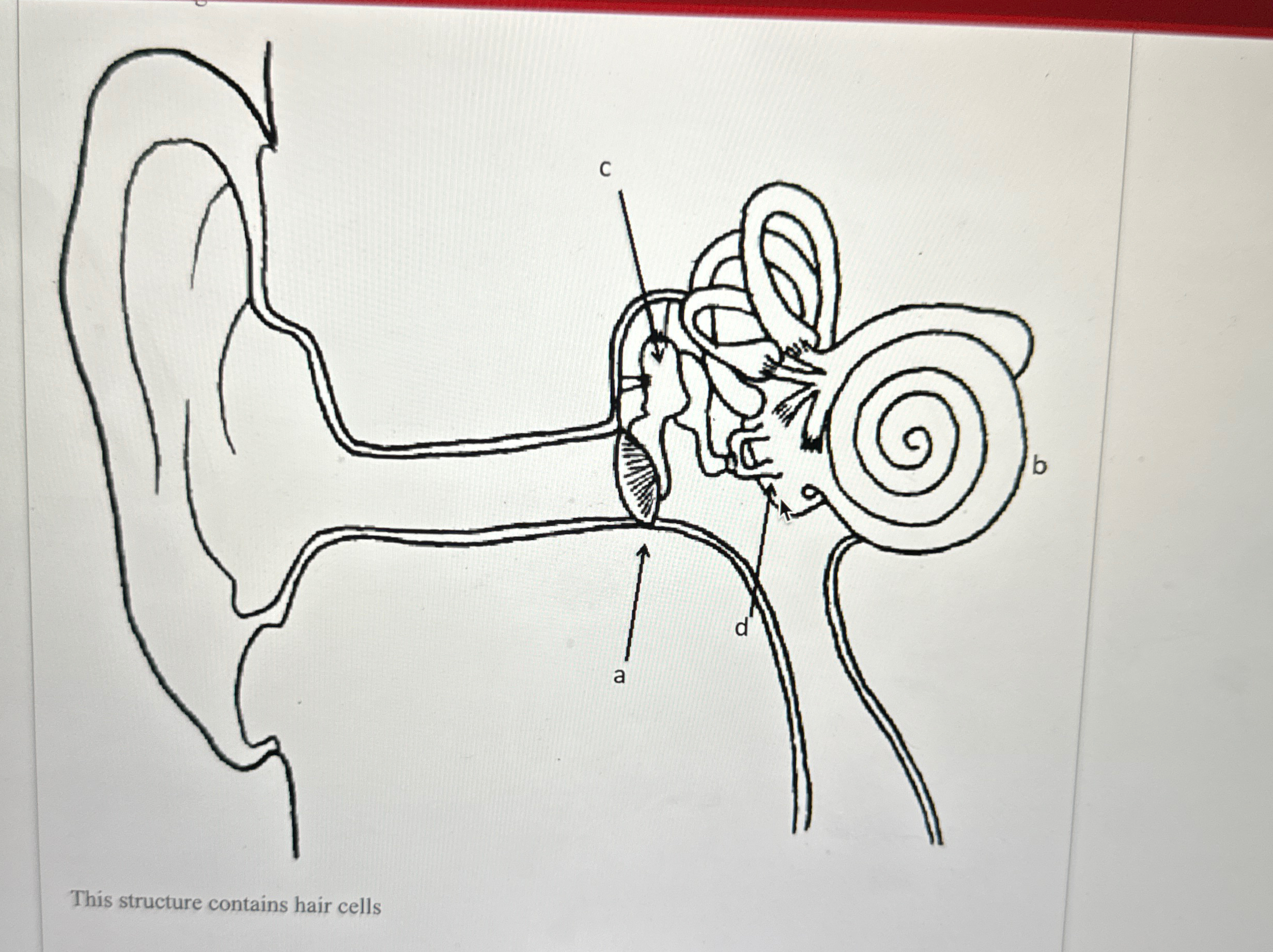 Solved In your ear, which structure contains Hair cells | Chegg.com