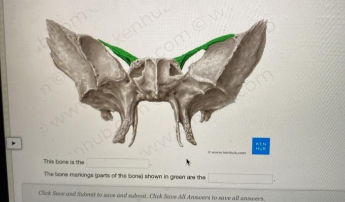 Solved enhus e com o om ww KEN HUN hub This bone is the The | Chegg.com