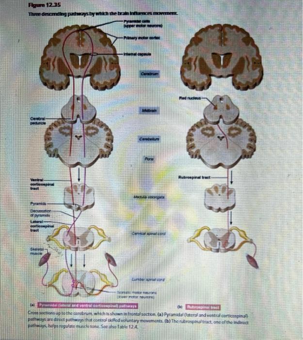 Solved A 54 year-old patient is admitted in a neurology | Chegg.com