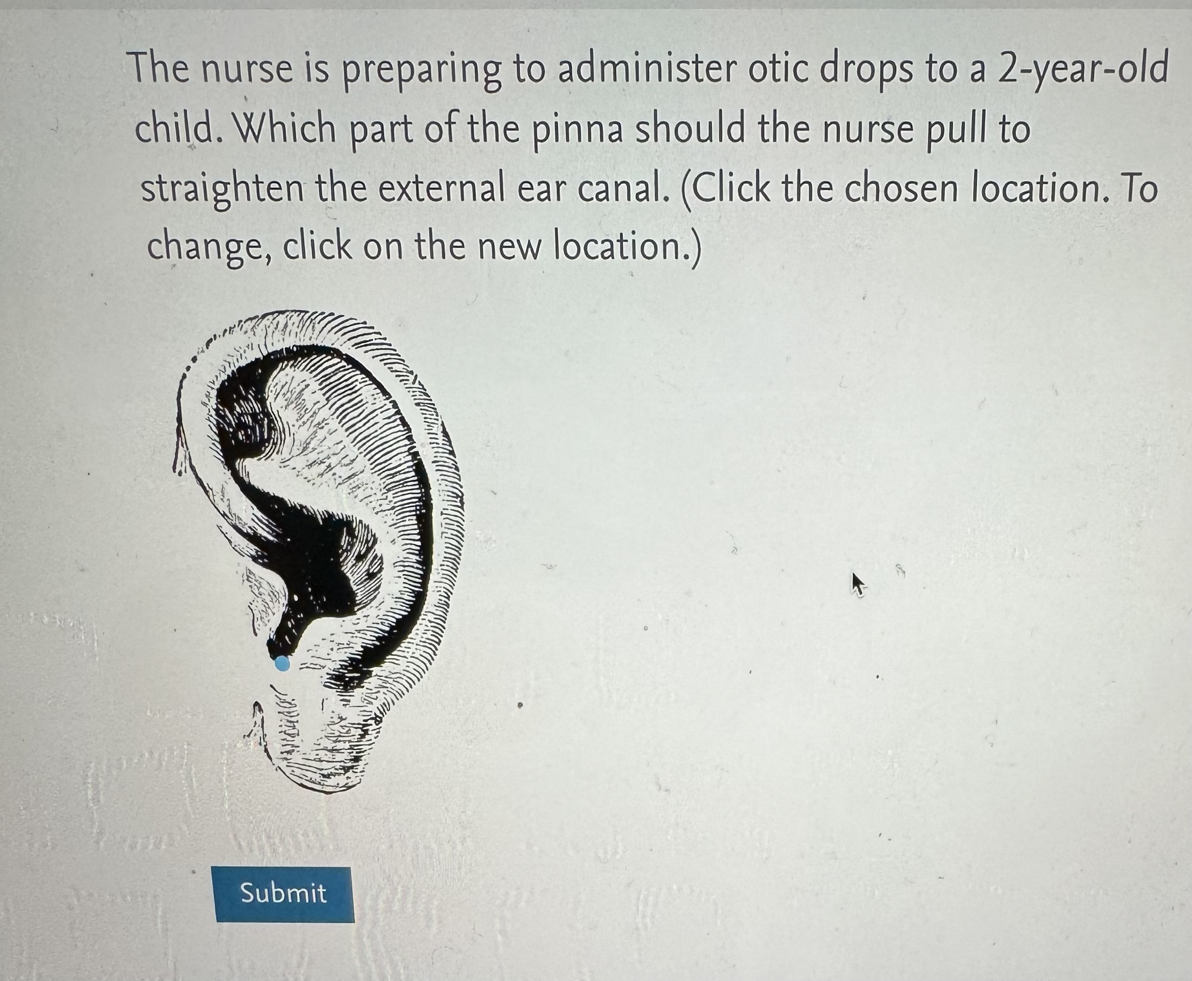 solved-the-nurse-is-preparing-to-administer-otic-drops-to-a-chegg