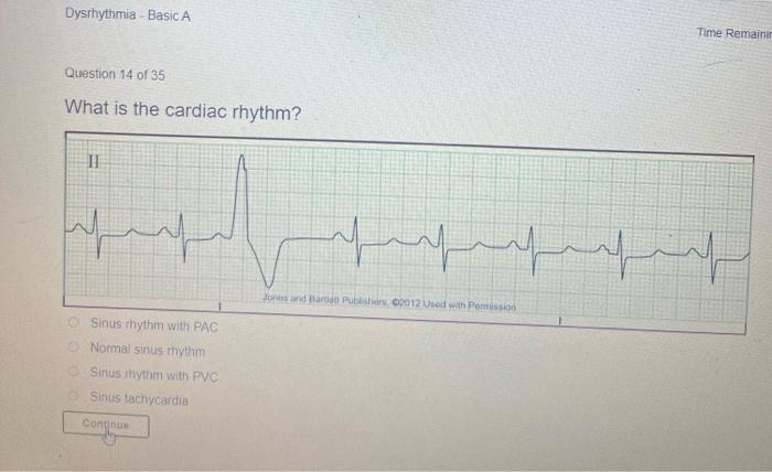 Solved Dysrhythmia Basic A Time Remaining: 10 Question 12 of | Chegg.com