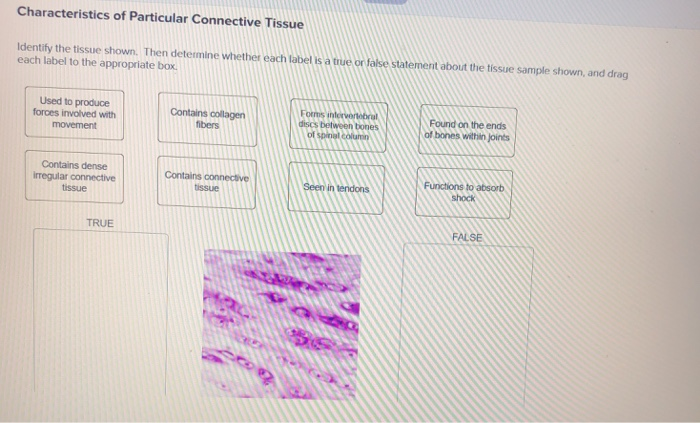 Solved Characteristics of Particular Connective Tissue | Chegg.com