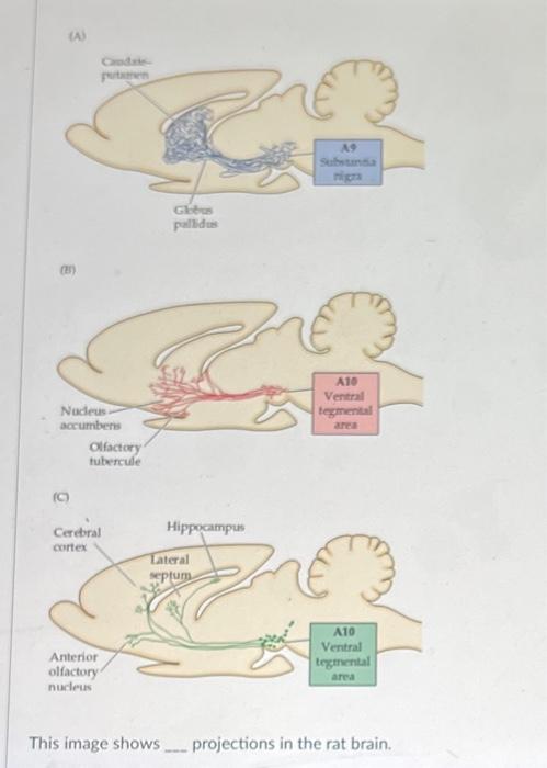 Solved This image shows projections in the rat brain. | Chegg.com