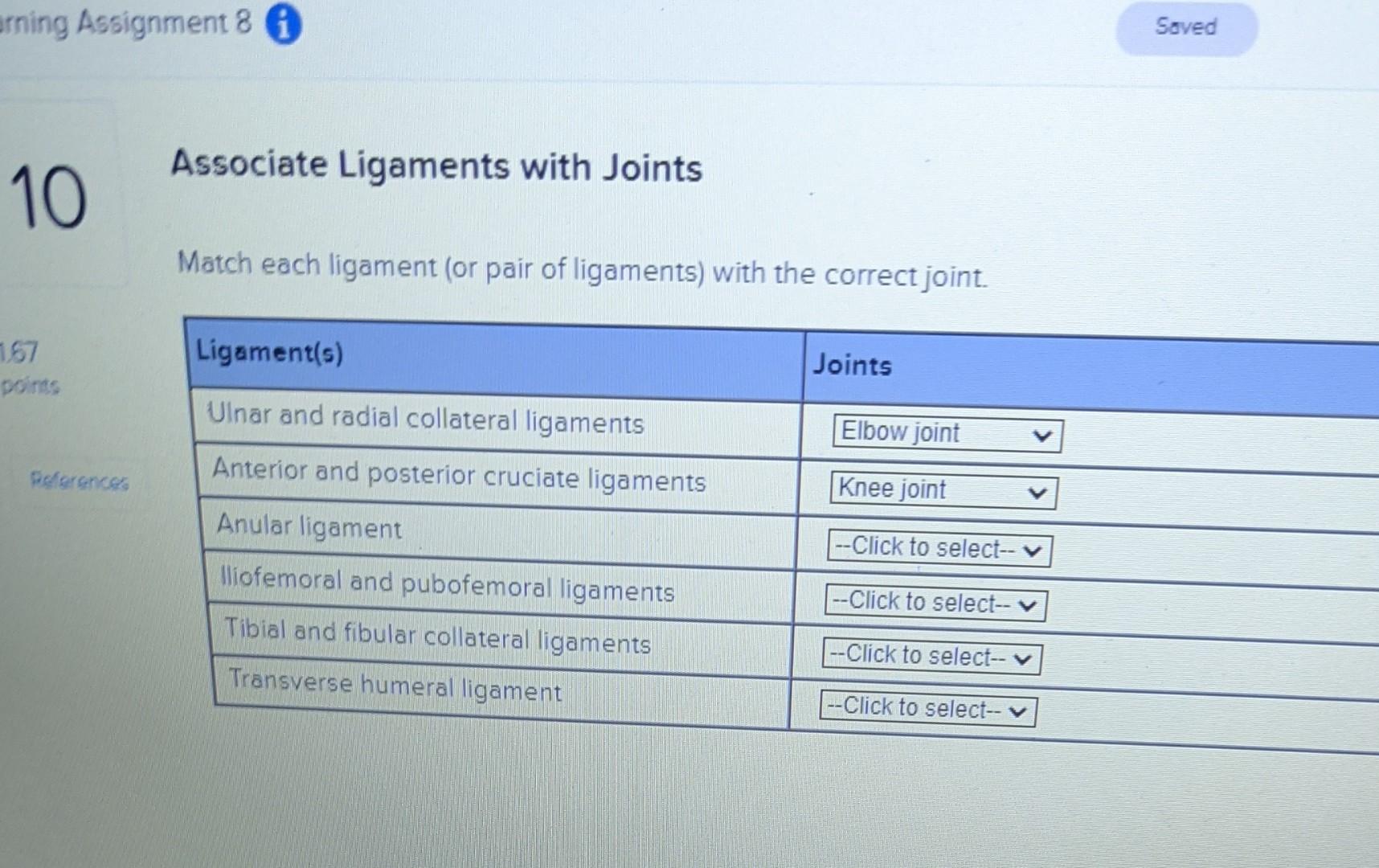 Solved Associate Ligaments with Joints Match each ligament