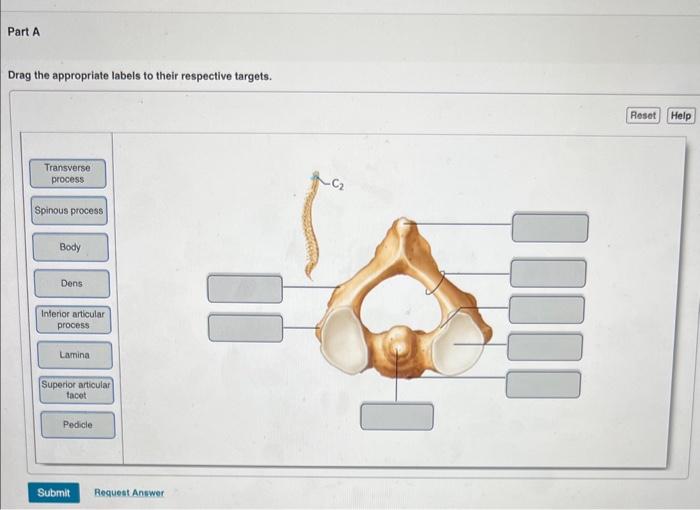 Solved Which part of a vertebra is known as the centrum? | Chegg.com