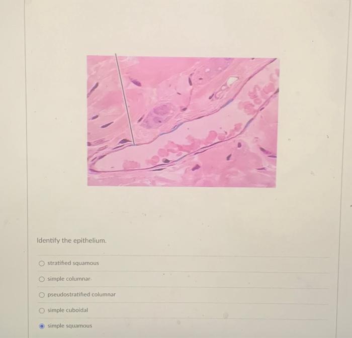 Identify the epithelium.
stratified squamous
simple columnar
pseudostratified columnar
simple cuboidal
simple squamous