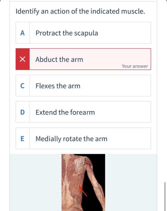 Solved Identify an action of the indicated muscle. A | Chegg.com