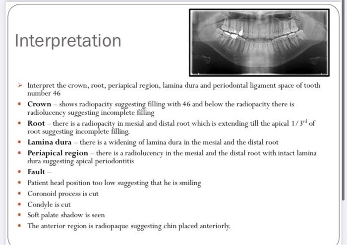 Interpretation Interpret the crown, root, periapical region, lamina dura and periodontal ligament space of tooth number 46 •