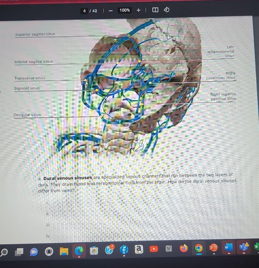 a. Dural venous sinuses are specialized venous channels that run between the two layers of dura. They drain blood and cerebro