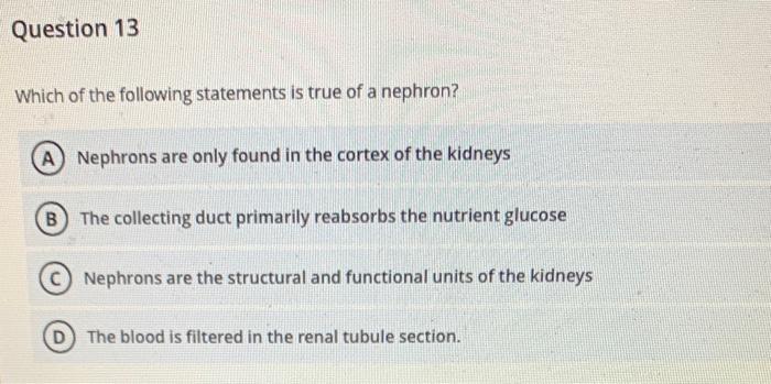 Solved Question 13 Which of the following statements is true | Chegg.com