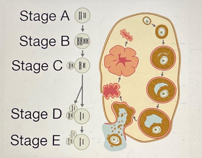 Solved Stage A IIII Stage B Stage C Stage D Stage E (11) | Chegg.com