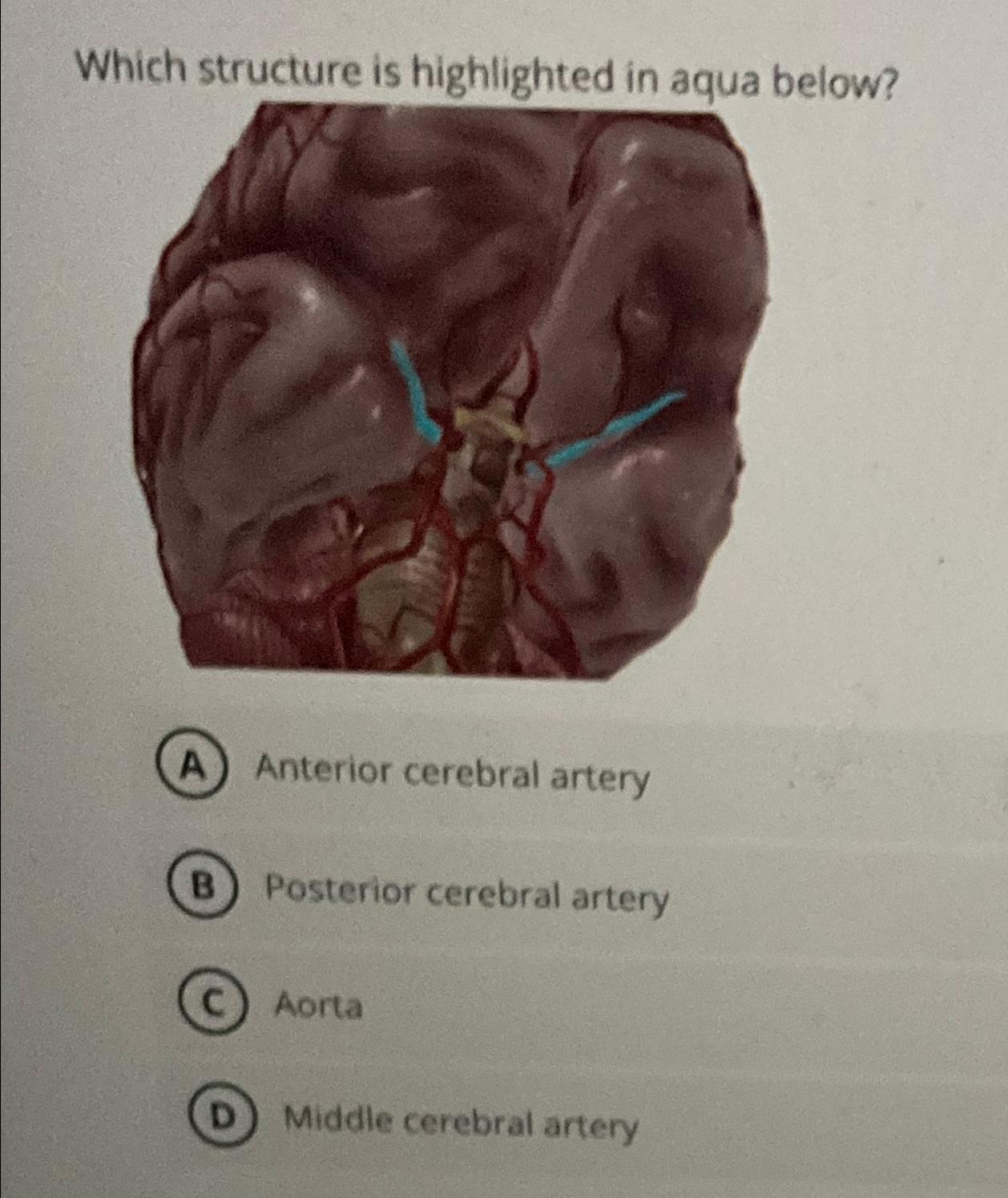 Solved Which structure is highlighted in aqua below?Anterior | Chegg.com