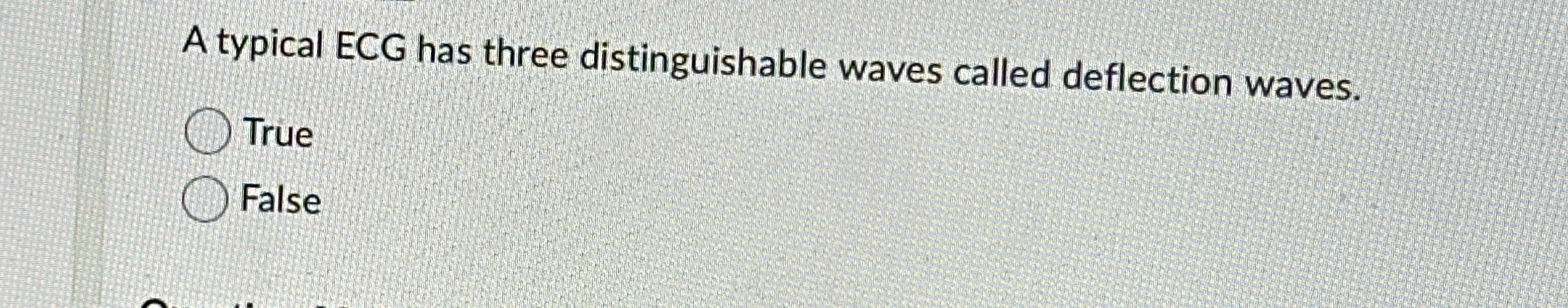Solved A typical ECG has three distinguishable waves called | Chegg.com