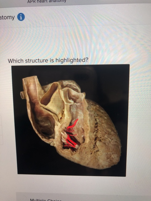 Which Structure Is Highlighted Heart