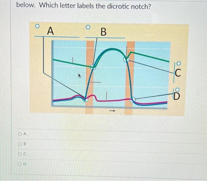 [Solved] below. Which letter labels the dicrotic notch?