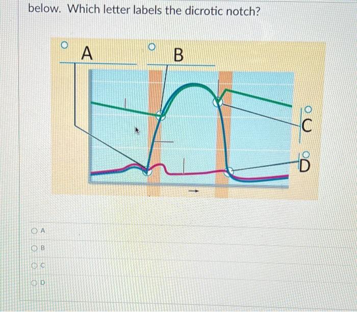 below. Which letter labels the dicrotic notch?