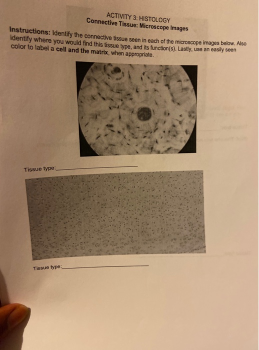 Solved ACTIVITY 3: HISTOLOGY Connective Tissue: Microscope | Chegg.com