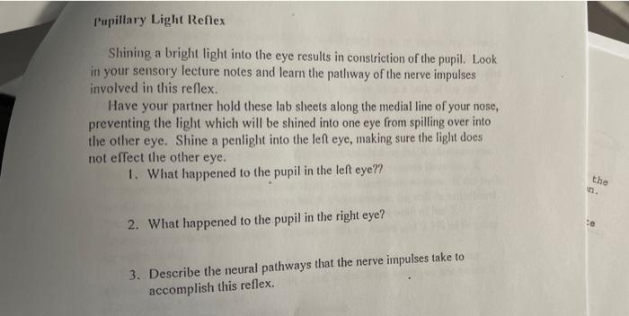 Solved Pupillary Light Reflex Shining a bright light into | Chegg.com
