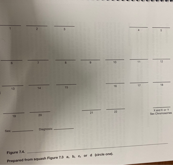 Solved 20 22 X And X Or Y Sex Chromosomes Sex Diagnosis