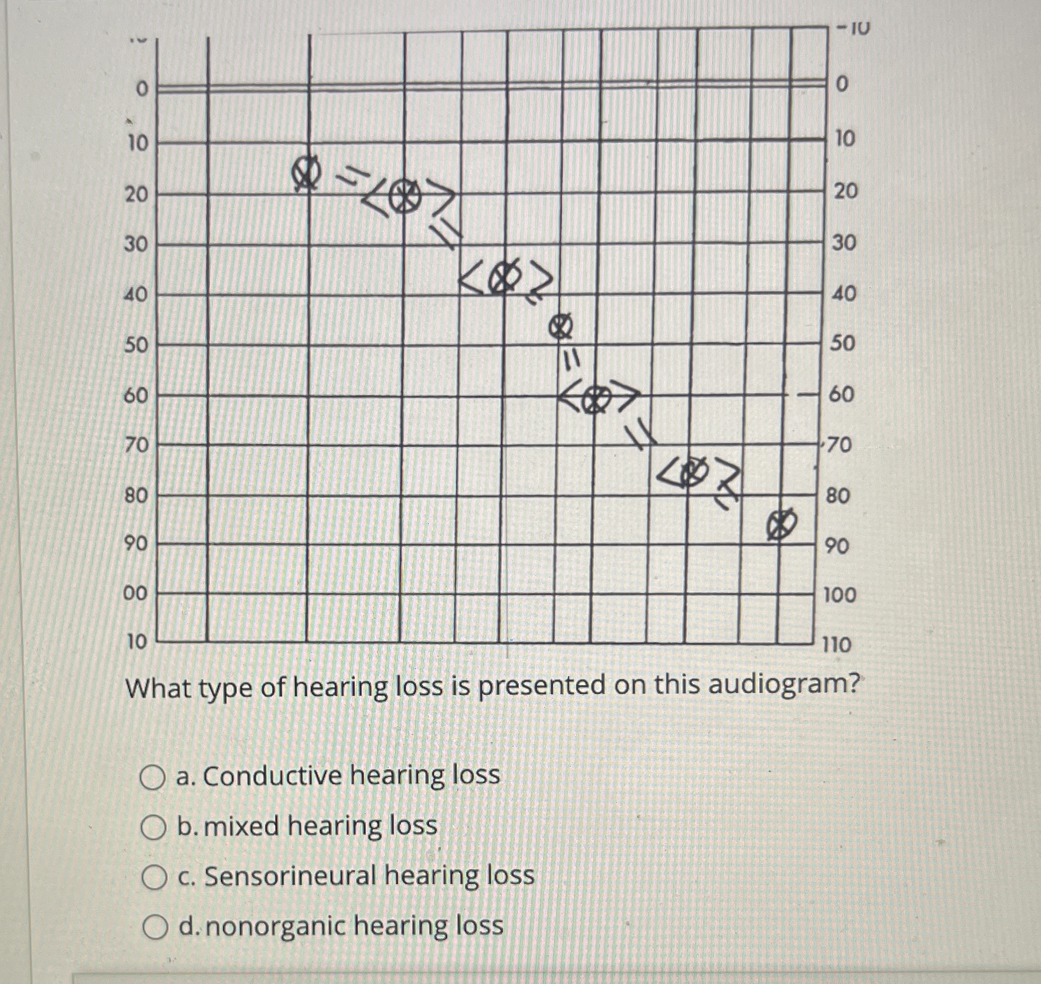 Solved What type of hearing loss is presented on this | Chegg.com