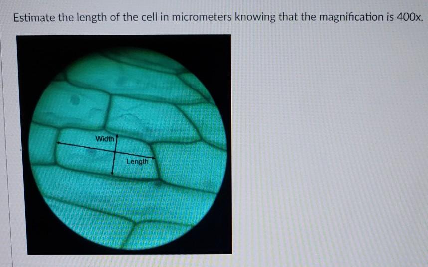Solved Estimate the length of the cell in micrometers